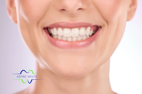 Follow your teeth whitening aftercare Walsall to prolong your whiter smile!