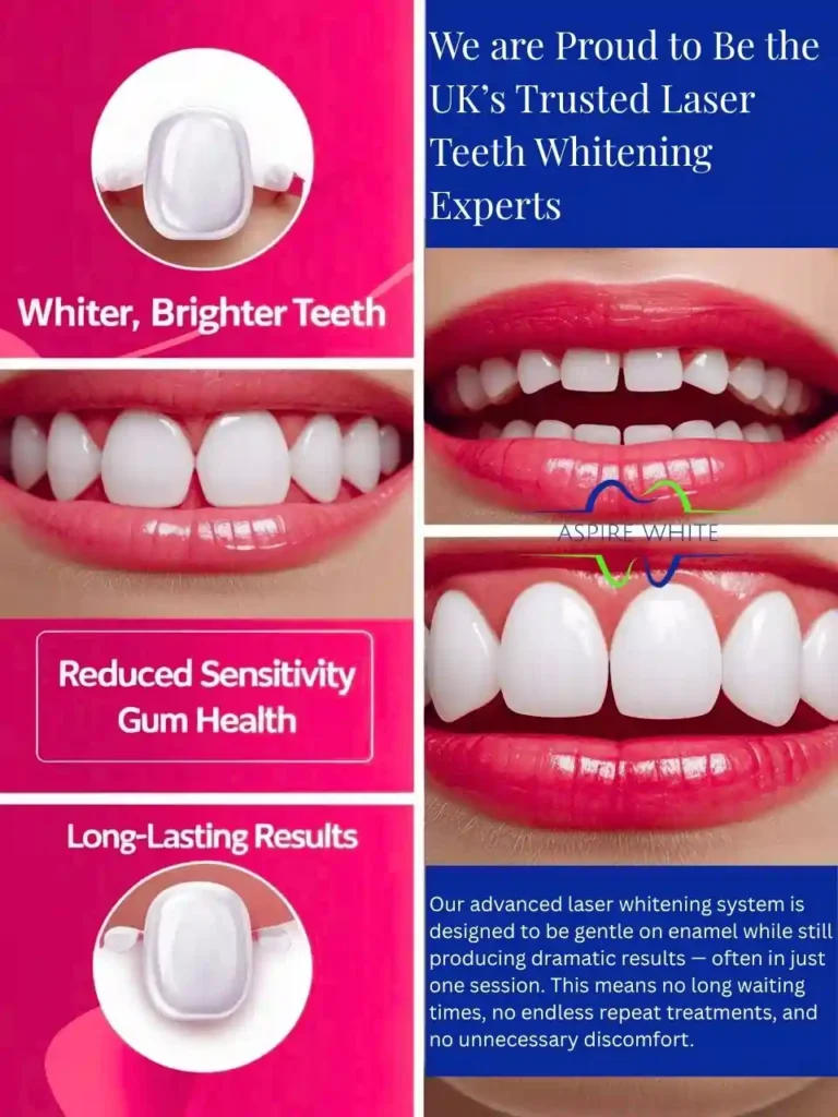 We are Proud to Be the UK’s Trusted Laser Teeth Whitening Experts Walsall